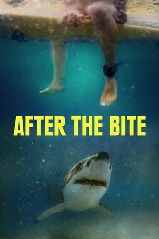 Poster zu Nach dem Biss: Die Folgen eines Haiangriffs