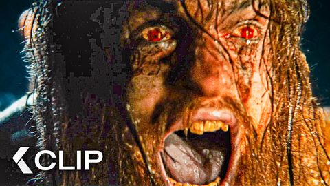 Image of Alpha Zombie Attack - 28 YEARS LATER Clip (2025)
